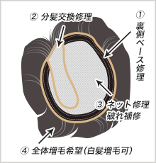 かつら修理箇所を示した図